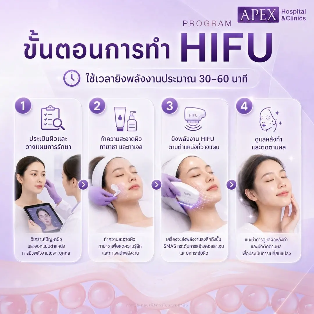 ขั้นตอนการทำ HIFU มีอะไรบ้าง
