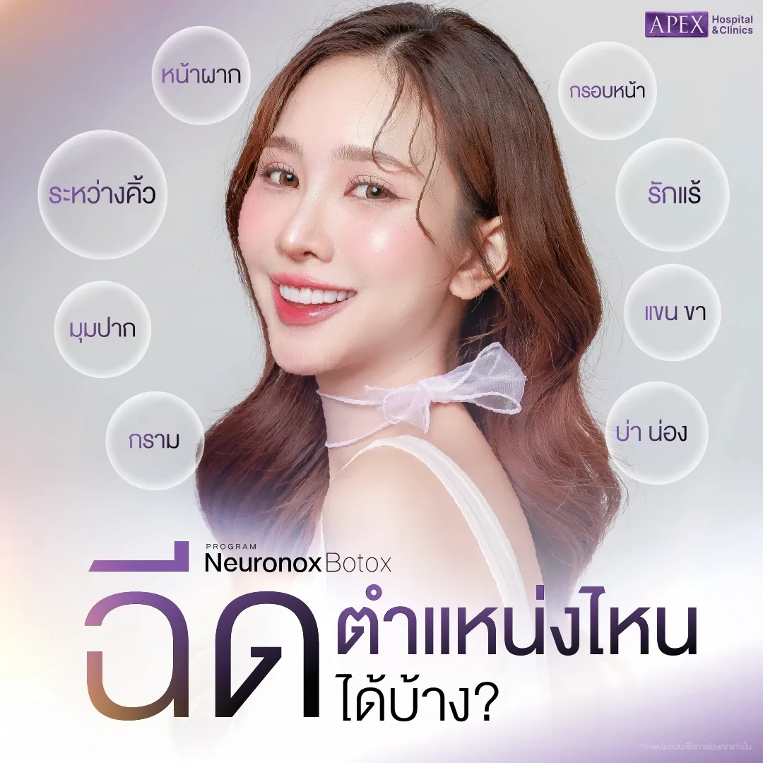 ฉีดโบท็อกซ์ Neuronox บริเวณไหนได้บ้าง