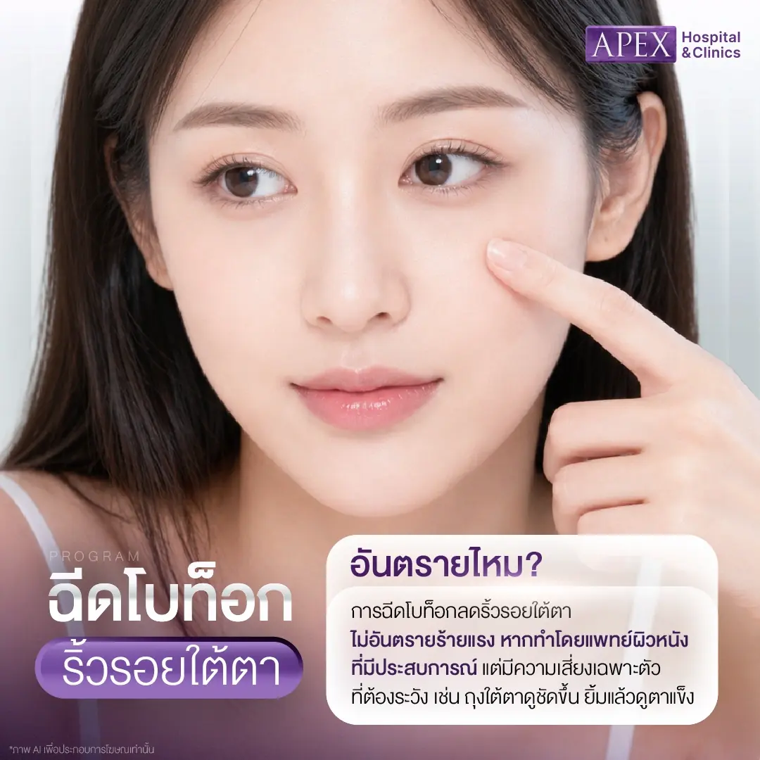 ฉีดโบท็อกริ้วรอยใต้ตา อันตรายไหม