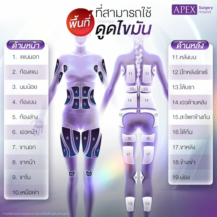 ตำแหน่ง ดูดไขมัน