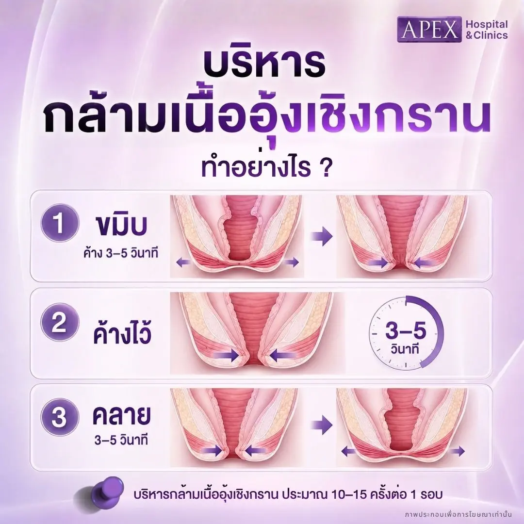 บริหารกล้ามเนื้ออุ้งเชิงกราน