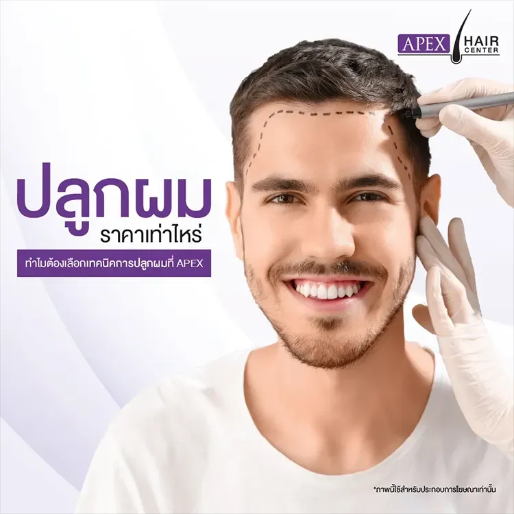 ปลูกผมราคา