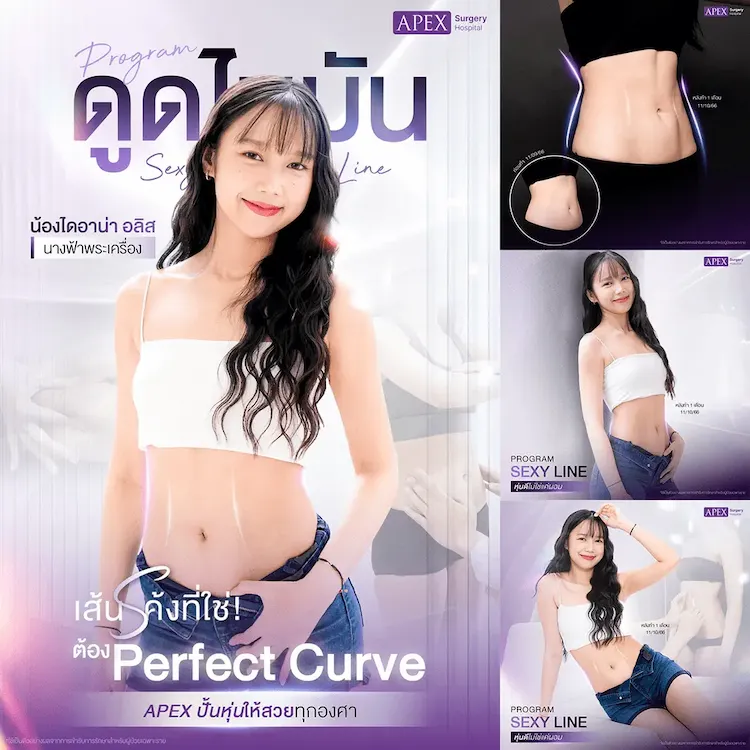 รีวิว ดูดไขมัน