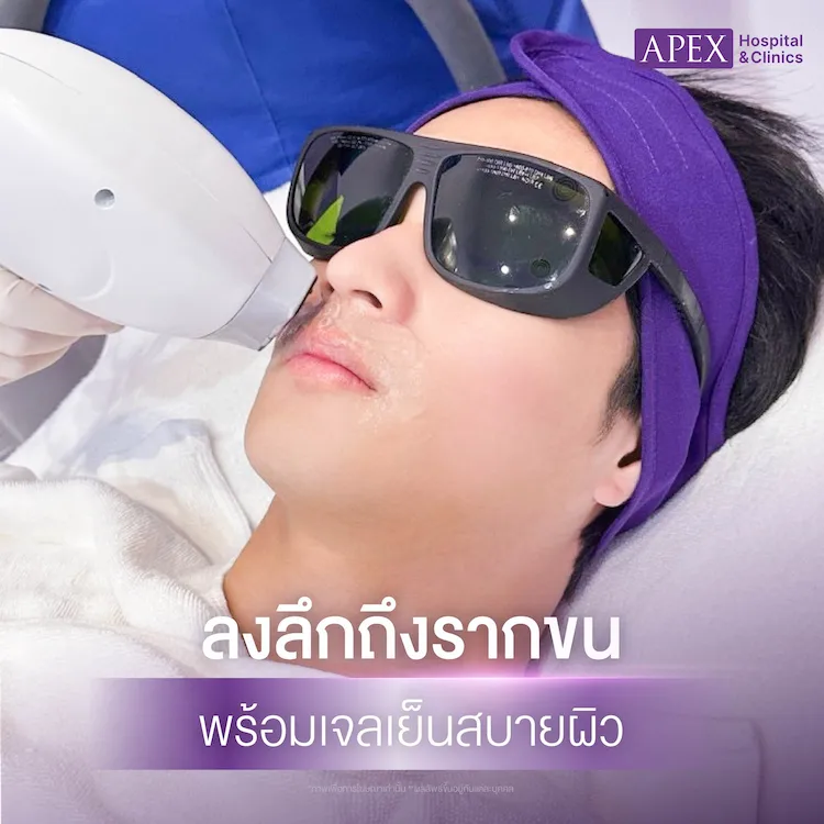 รีวิว เลเซอร์หนวด