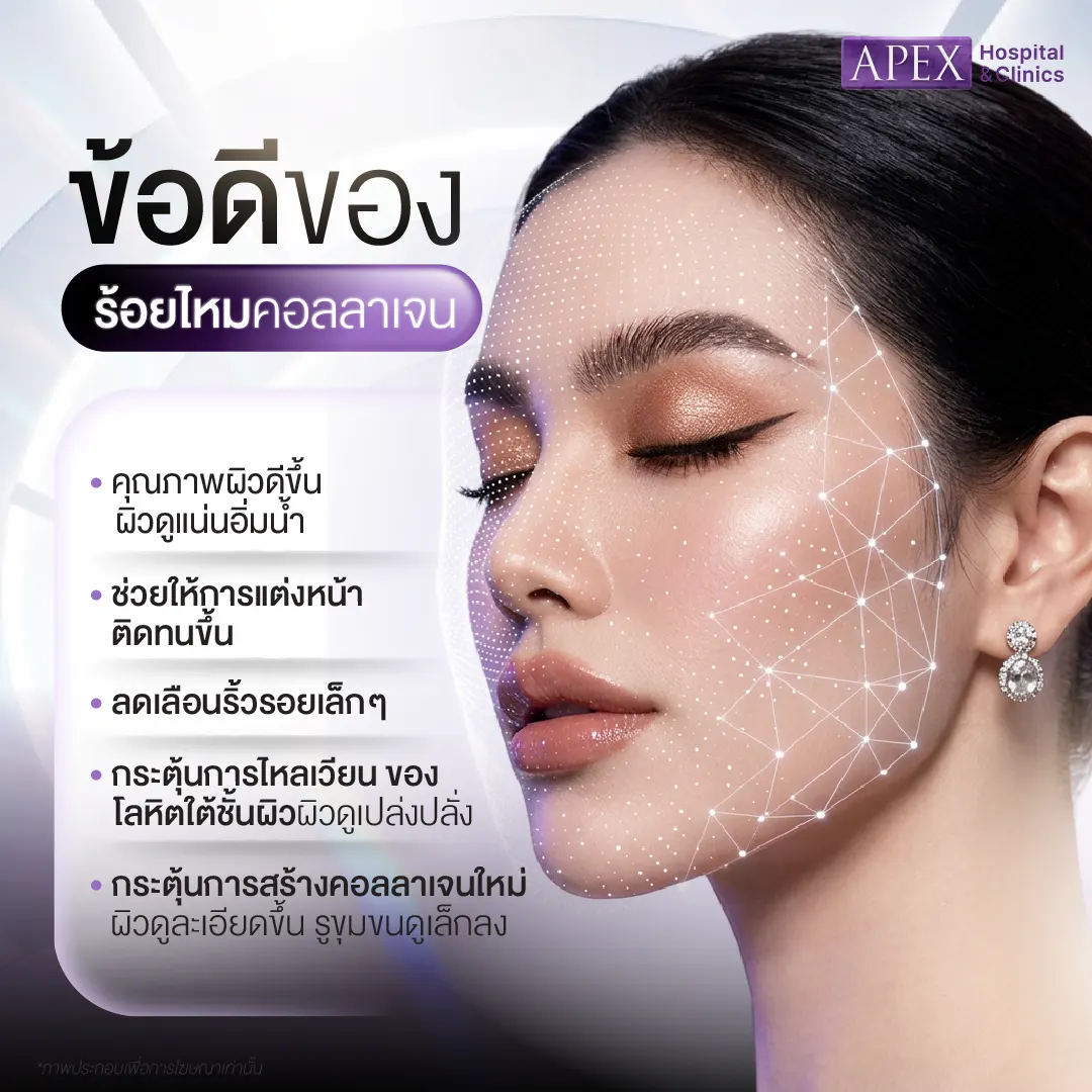 ร้อยไหมคอลลาเจน ช่วยเรื่องอะไร