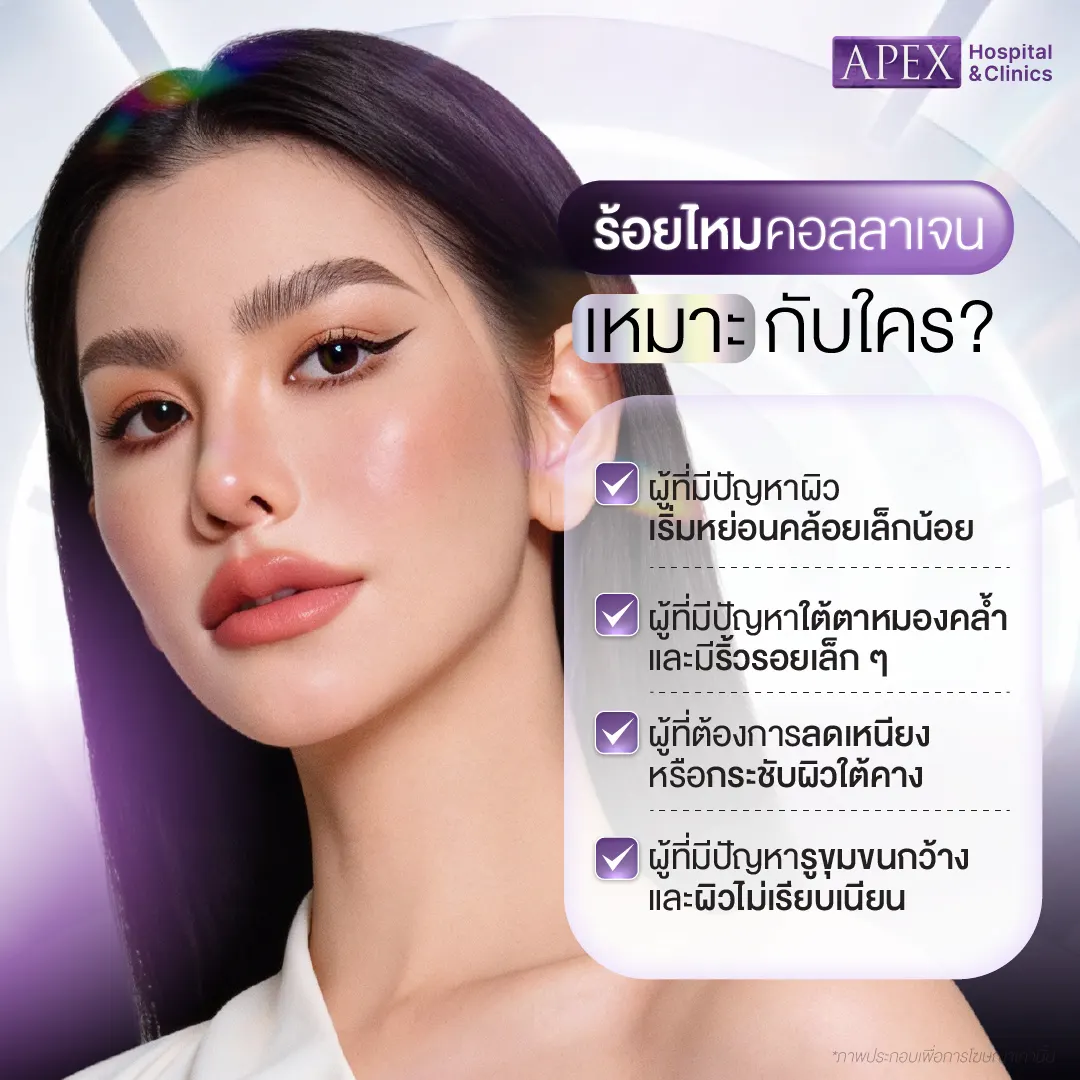ร้อยไหมคอลลาเจน เหมาะกับใคร