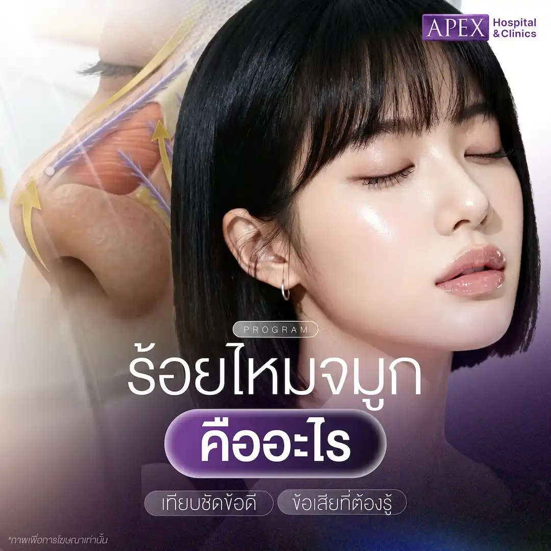ร้อยไหมจมูก คืออะไร ข้อดี ข้อจำกัด ความเสี่ยง และสิ่งที่ควรรู้ก่อนทำ