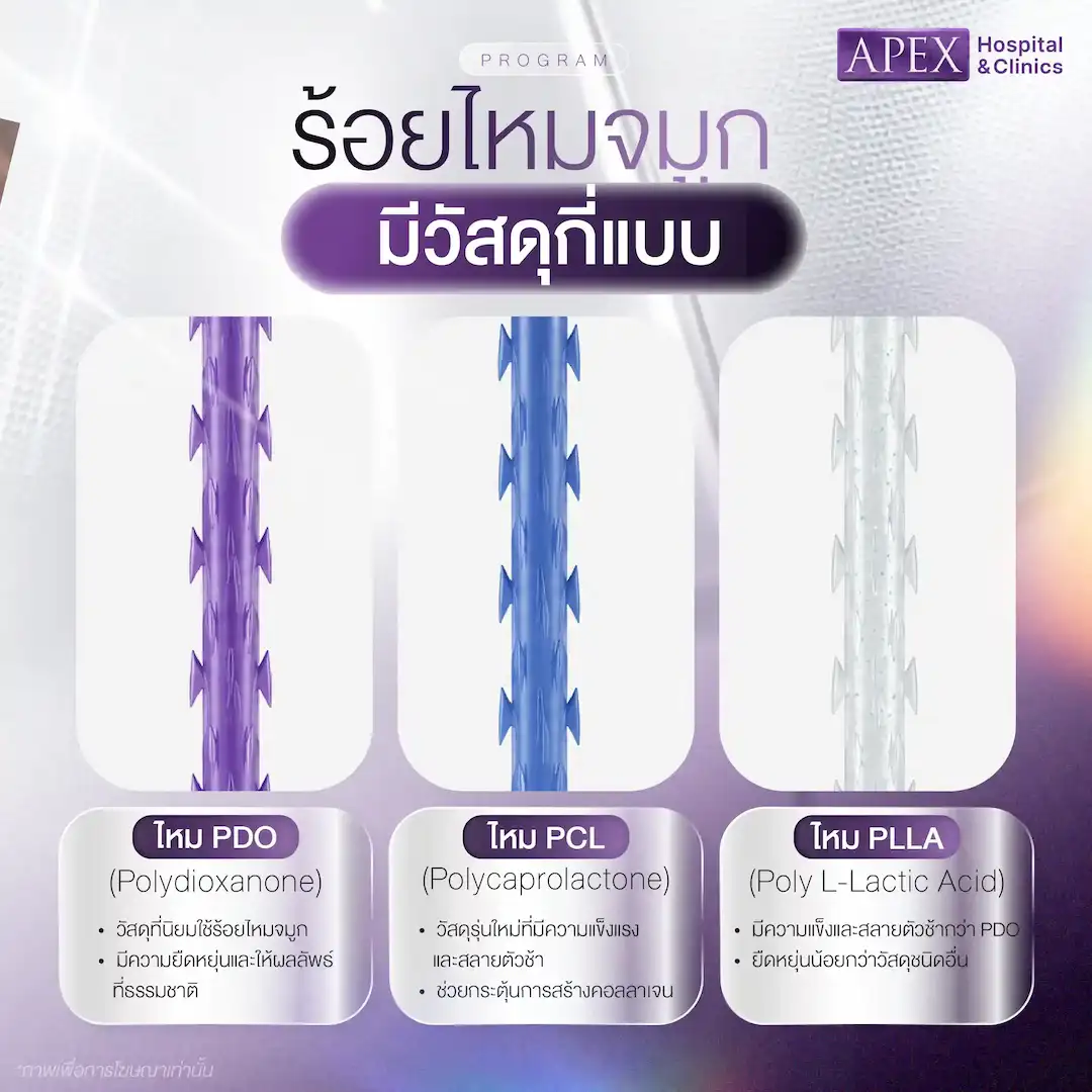 วัสดุในการร้อยไหมจมูกมีกี่แบบ