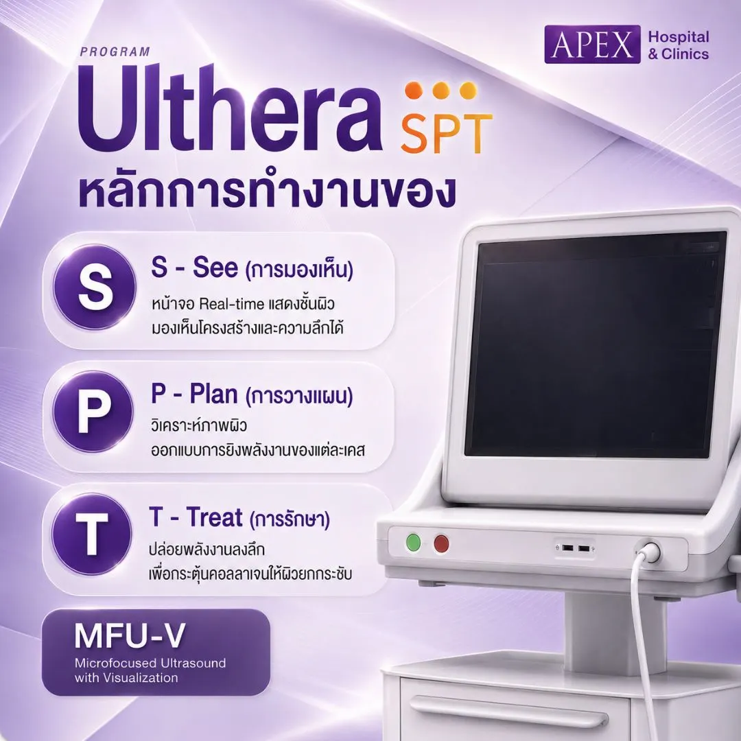 หลักการทำงานของเครื่อง Ulthera SPT
