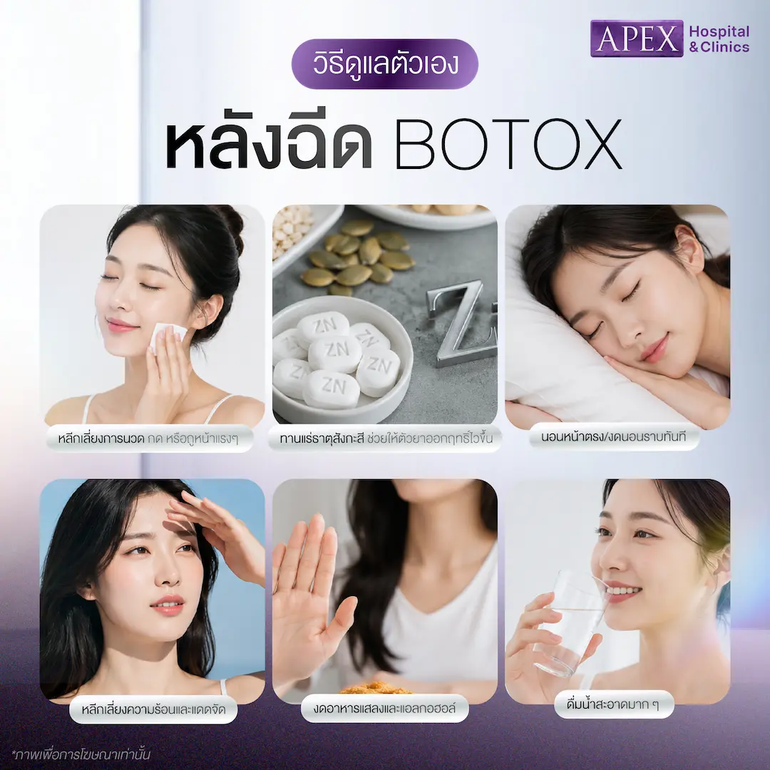 หลังฉีด Dysport Botox