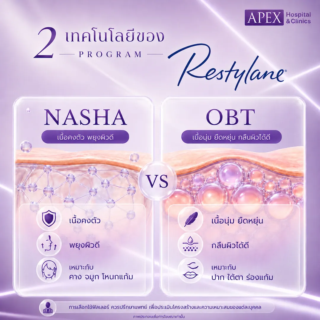 เทคโนโลยีฟิลเลอร์ Restylane