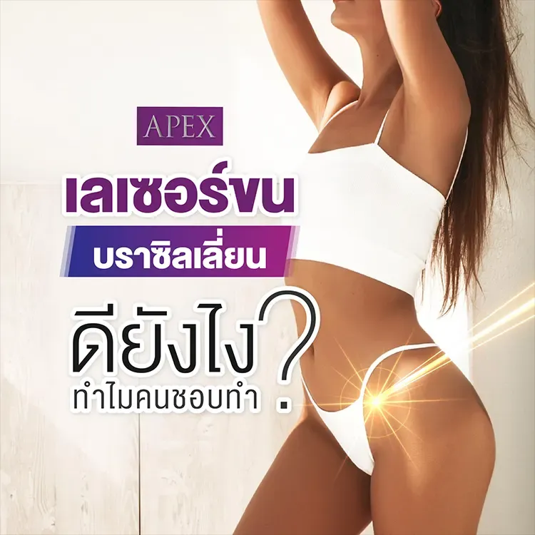 เลเซอร์บราซิลเลี่ยน