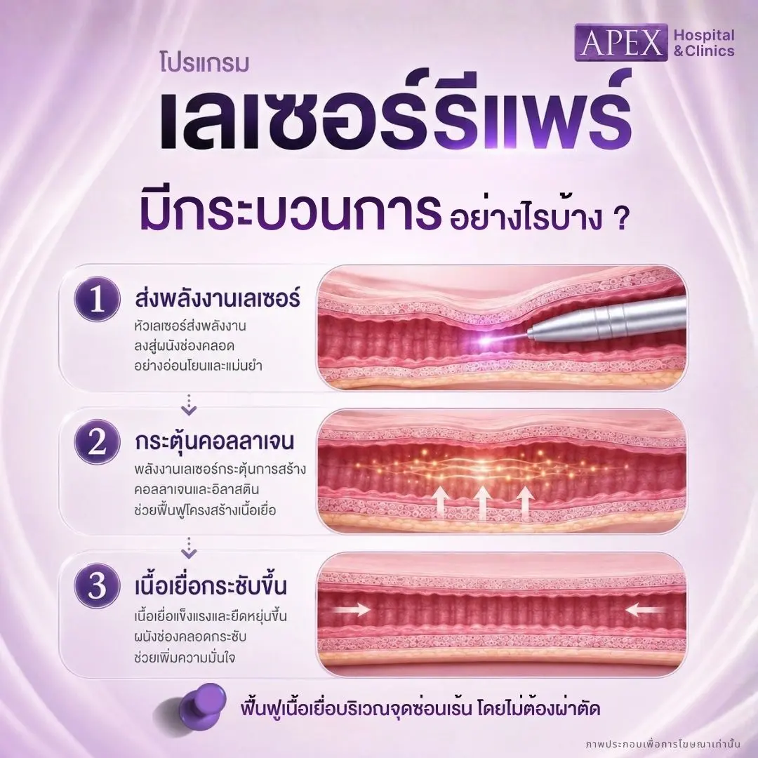 เลเซอร์รีแพร์