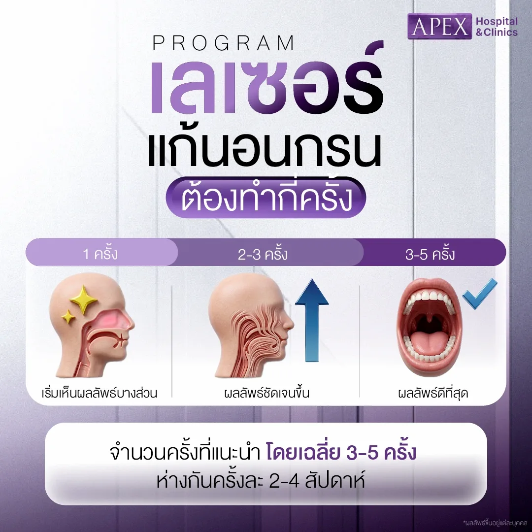 เลเซอร์แก้นอนกรน ทำกี่ครั้งถึงเห็นผล