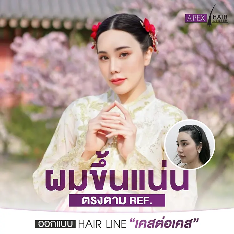 ใครที่เหมาะกับการปลูกผมเทคนิคแขนกล