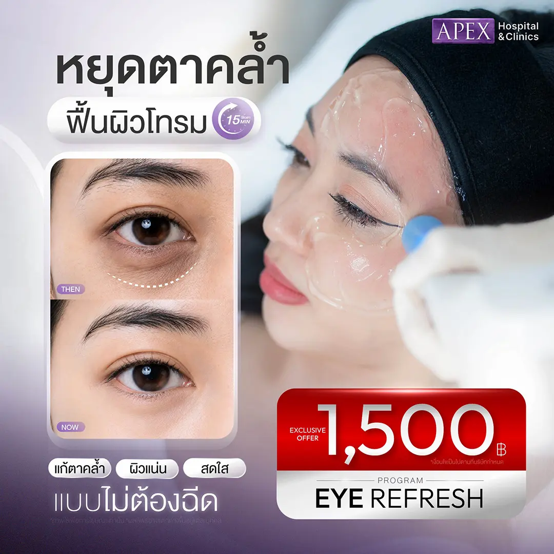 Eye Refresh ราคา