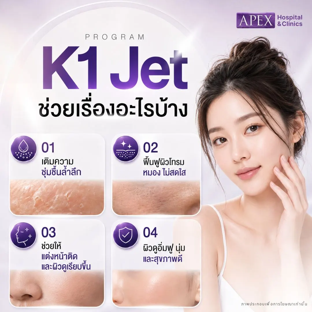 K1 Jet ช่วยเรื่องอะไร
