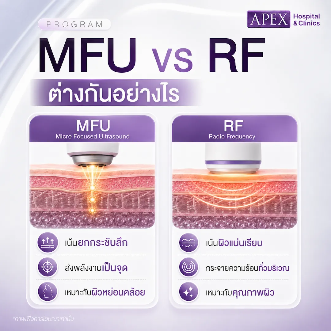 Micro Focused Ultrasound ต่างจากคลื่นวิทยุ RF อย่างไร