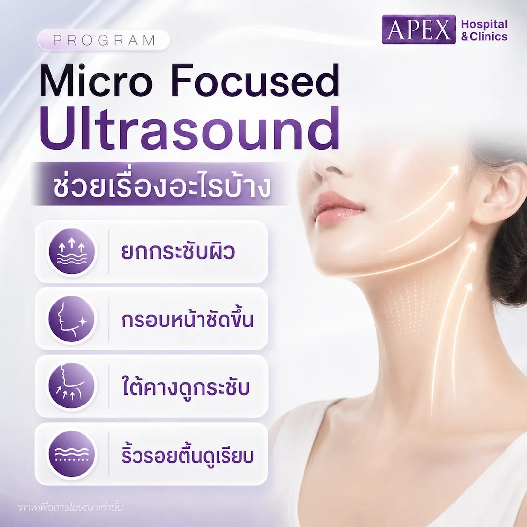 Micro Focused Ultrasound ช่วยเรื่องอะไร