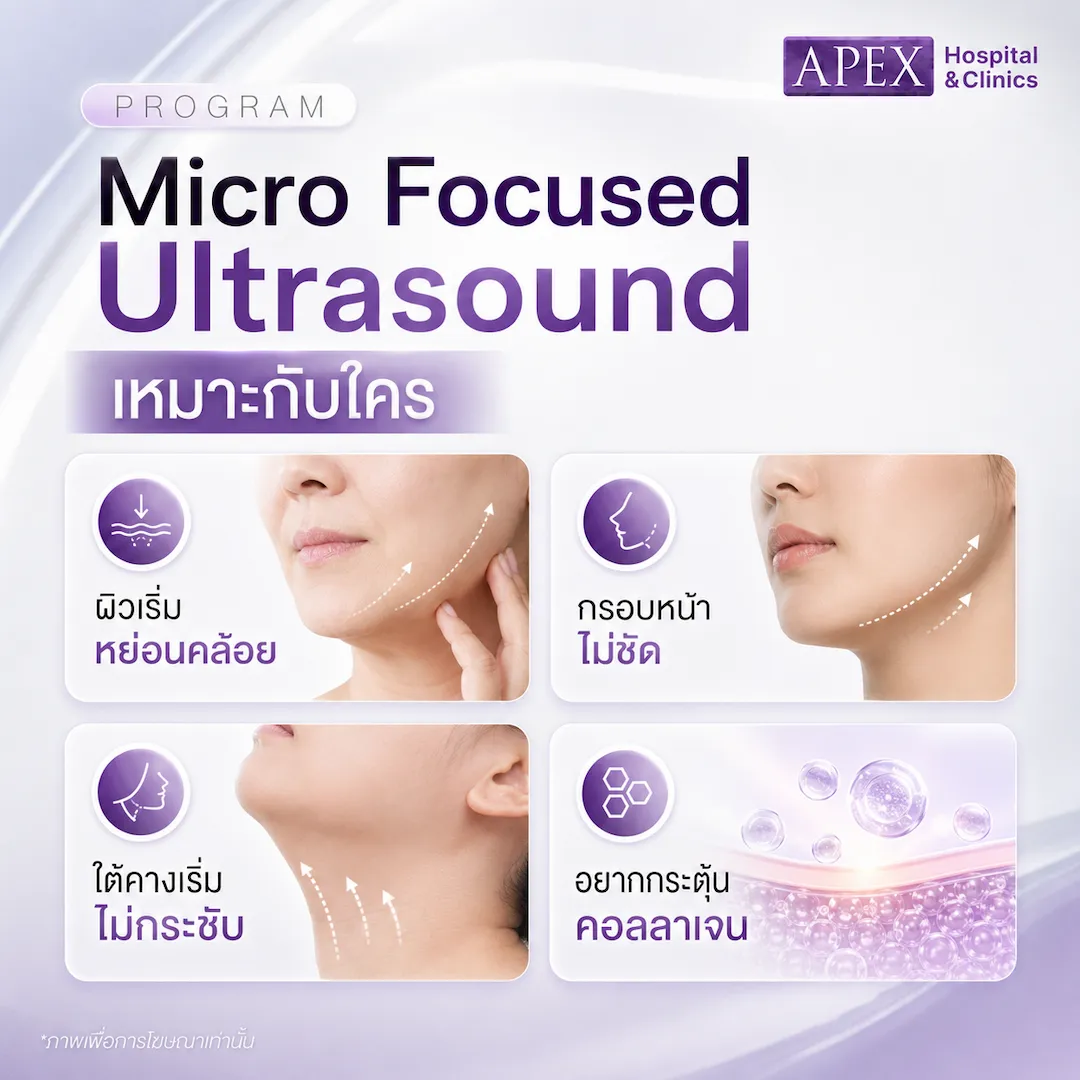 Micro Focused Ultrasound เหมาะกับใคร