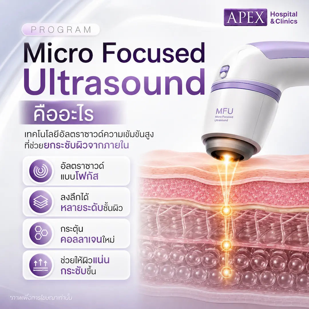 Micro Focused Ultrasound คืออะไร