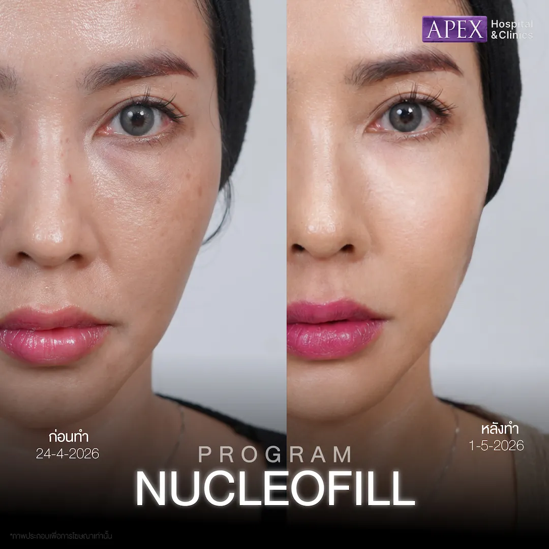 รีวิว Nucleofill