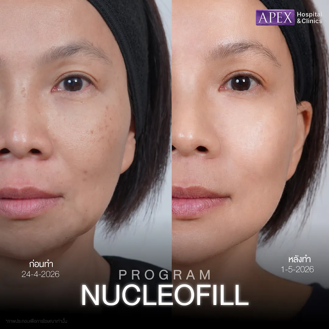 รีวิว Nucleofill