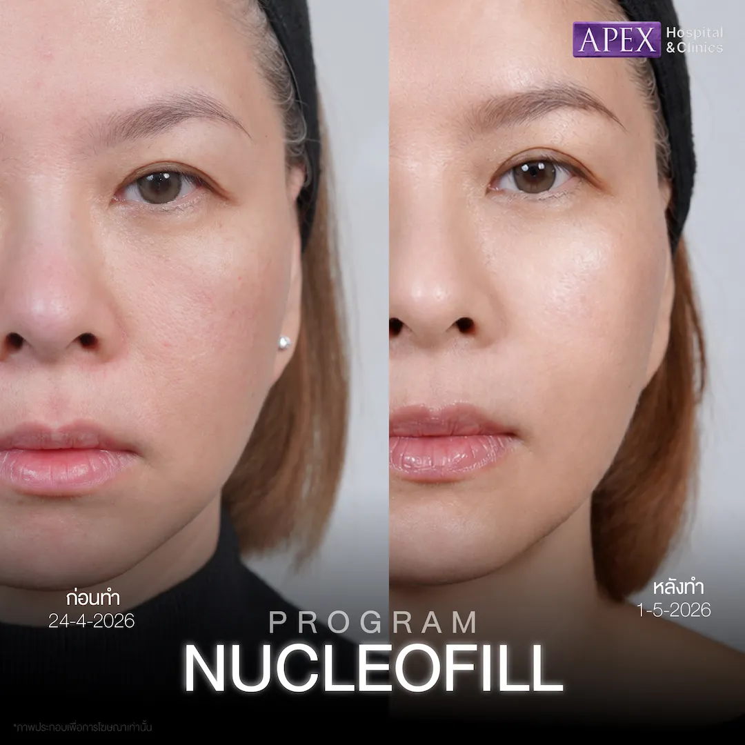รีวิว Nucleofill