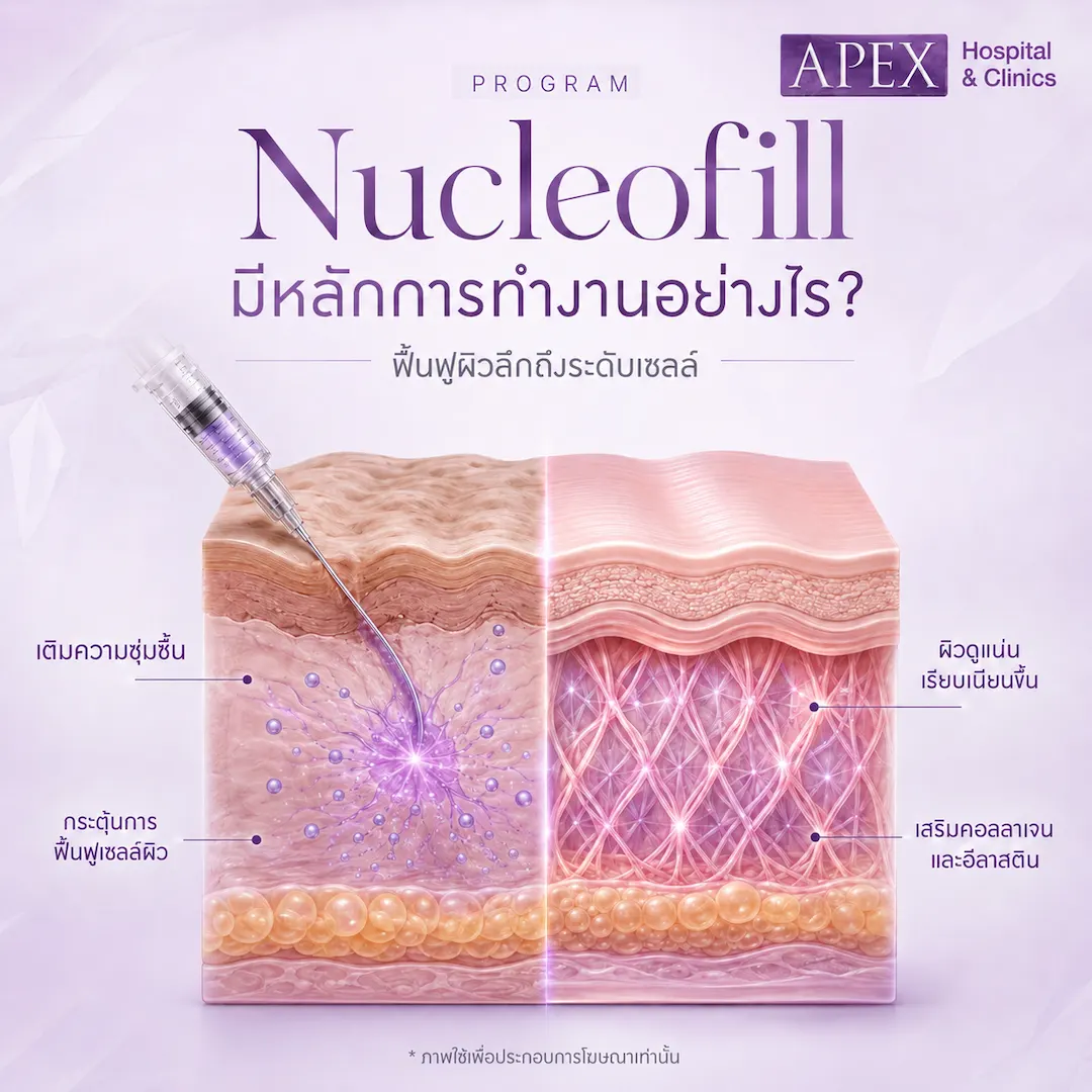 Nucleofill ทำงานกับผิวอย่างไร
