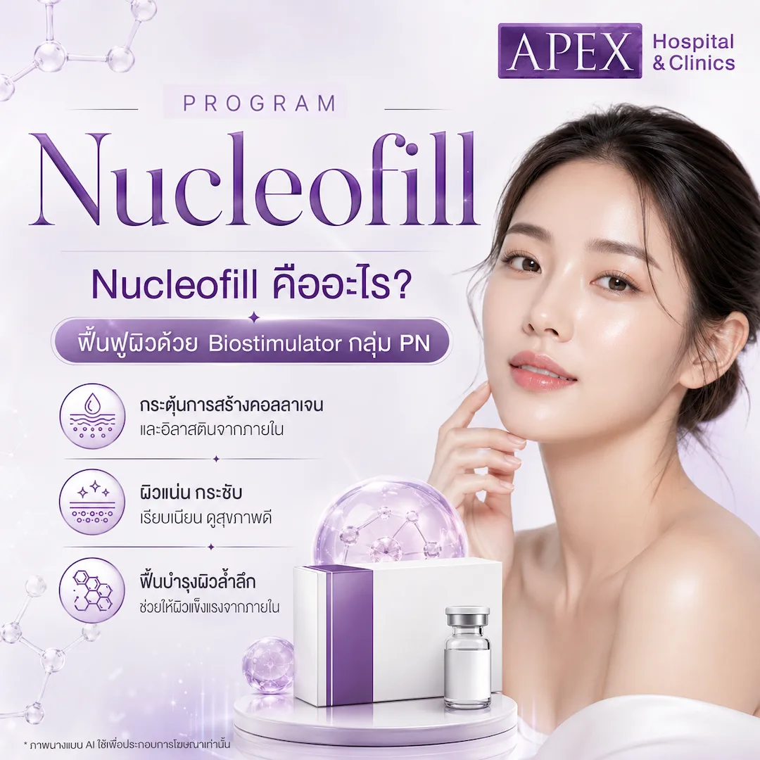 Nucleofill