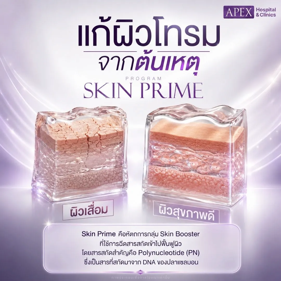 Skin Prime คืออะไร