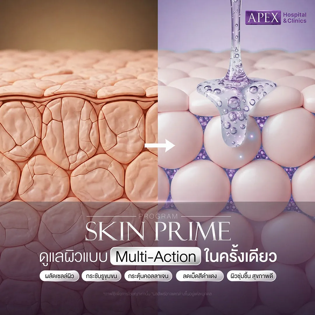 Skin Prime ช่วยอะไร