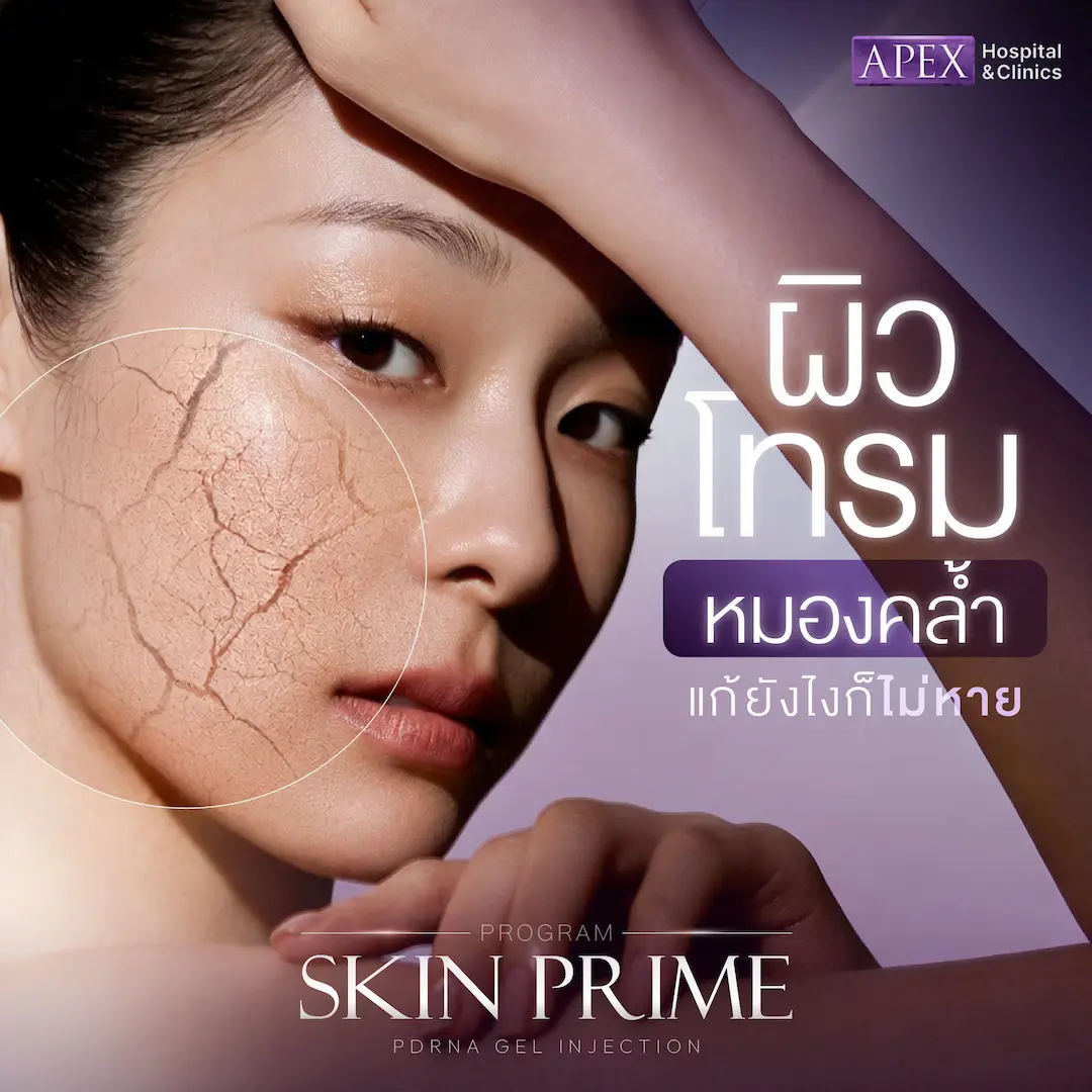 Skin Prime