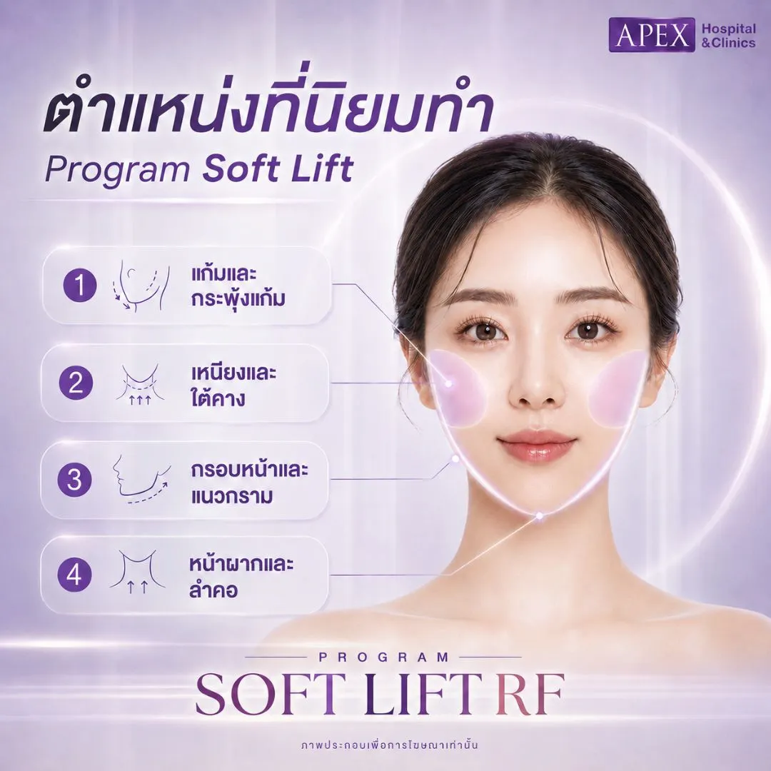 Soft Lift RF ทำตำแหน่งไหนได้บ้าง