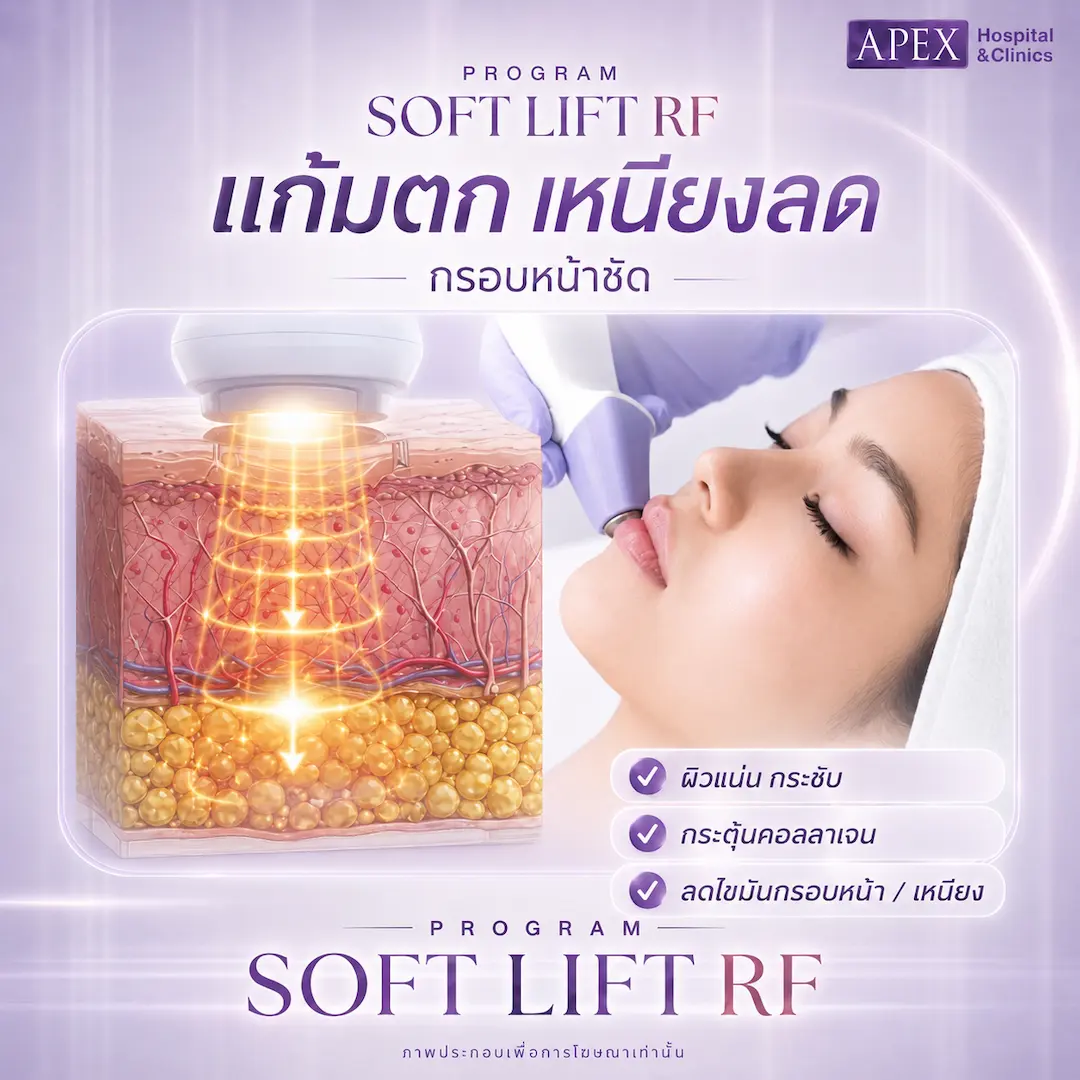 Soft Lift RF