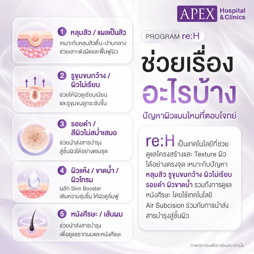 re:H ช่วยเรื่องอะไร