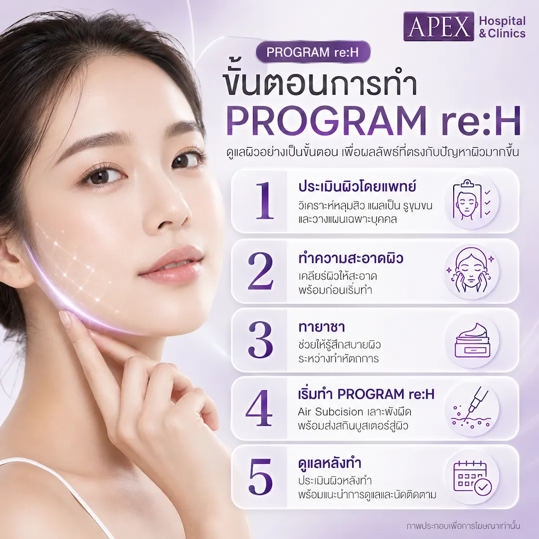 ขั้นตอนการทำ re:H