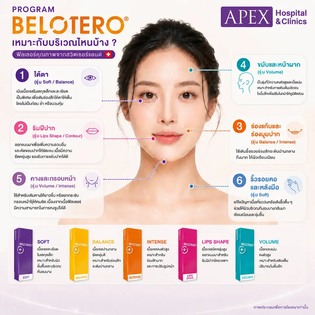 ฟิลเลอร์ Belotero แต่ละรุ่นเหมาะกับฉีดจุดไหน