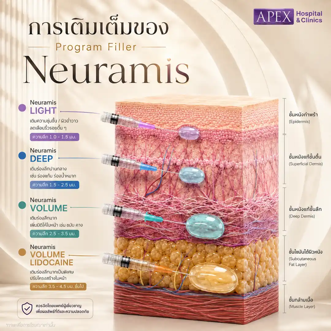 ฟิลเลอร์ Neuramis มีรุ่นไหนบ้าง