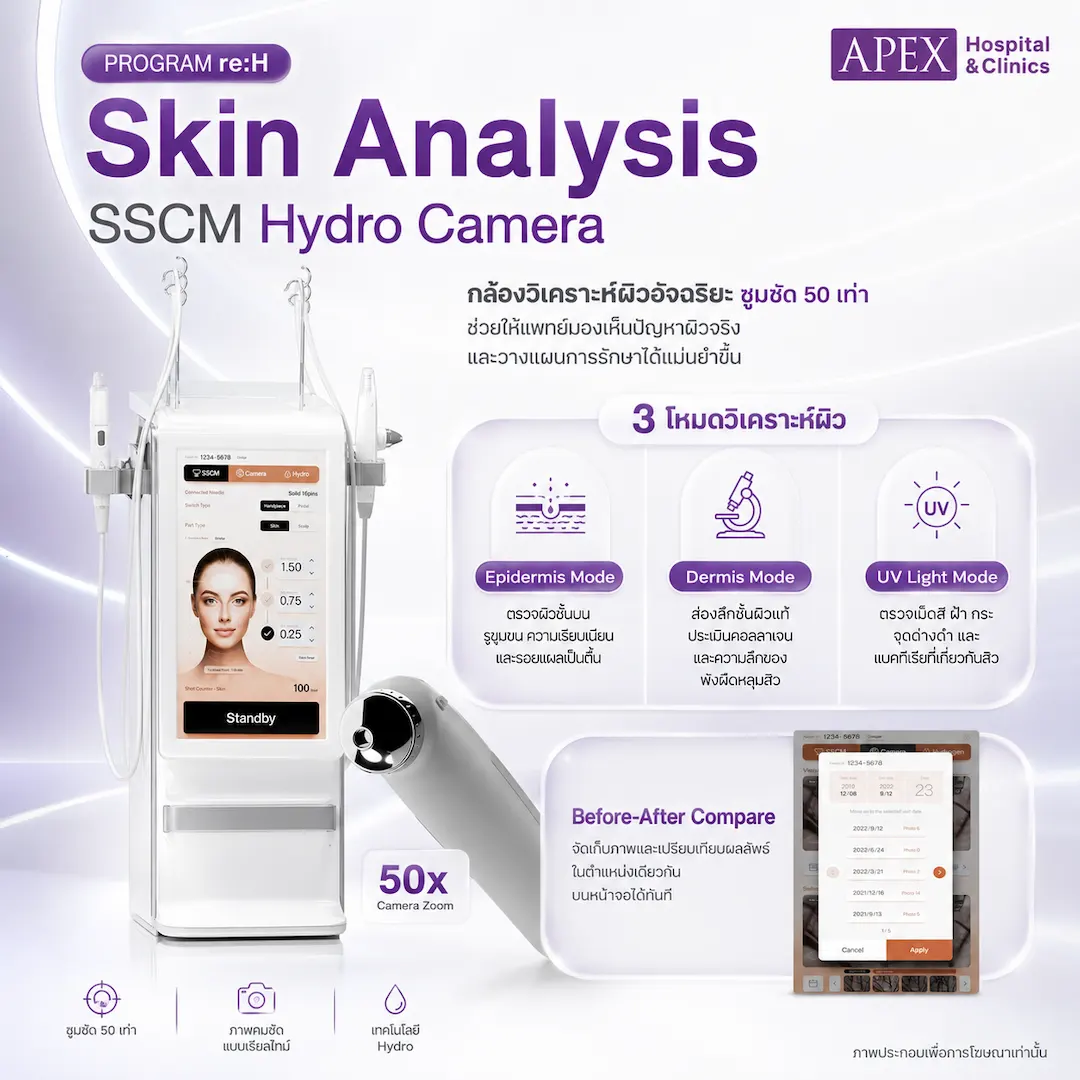 ระบบ Skin Analysis ของ re:H