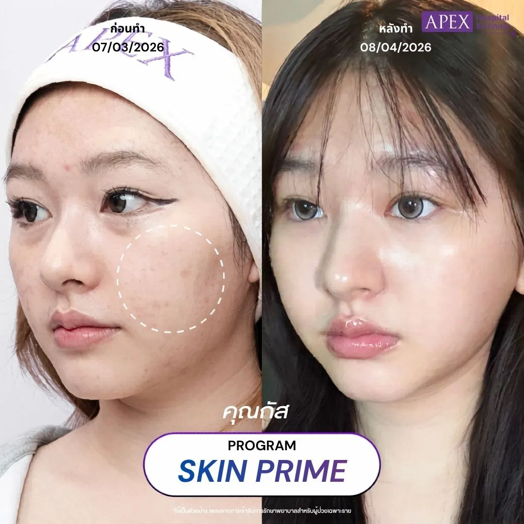 รีวิว Skin Prime