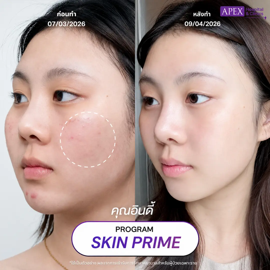 รีวิว Skin Prime