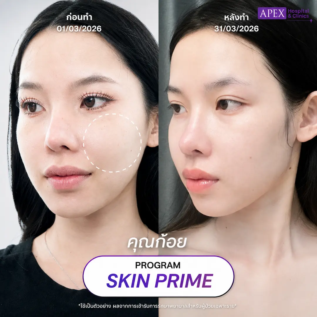 รีวิว Skin Prime