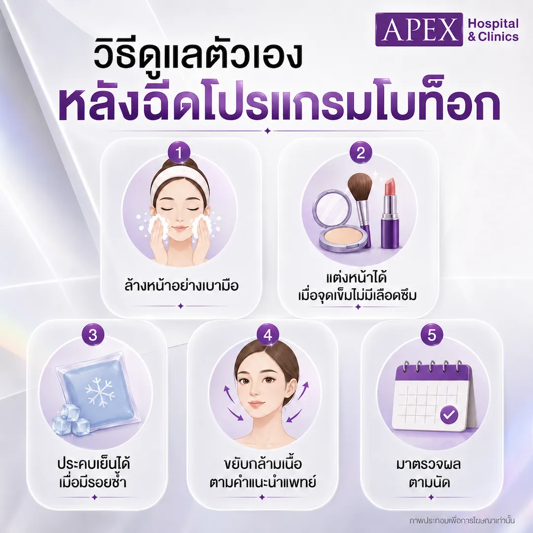 วิธีดูแลตัวเอง หลังฉีดโบท็อก