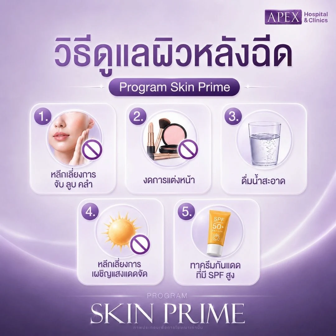 วิธีดูแลหลังฉีด Skin Prime
