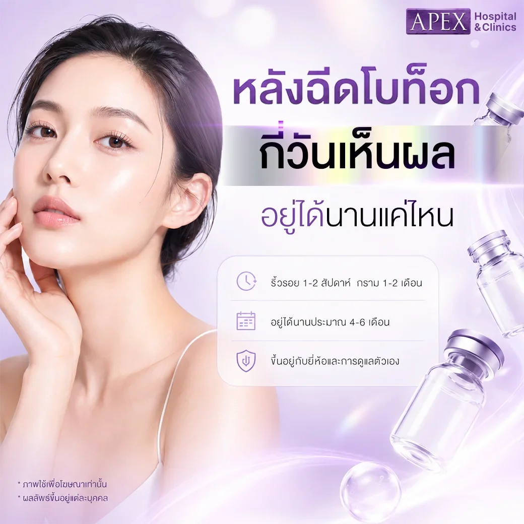 หลังฉีดโบท็อก กี่วันเห็นผล