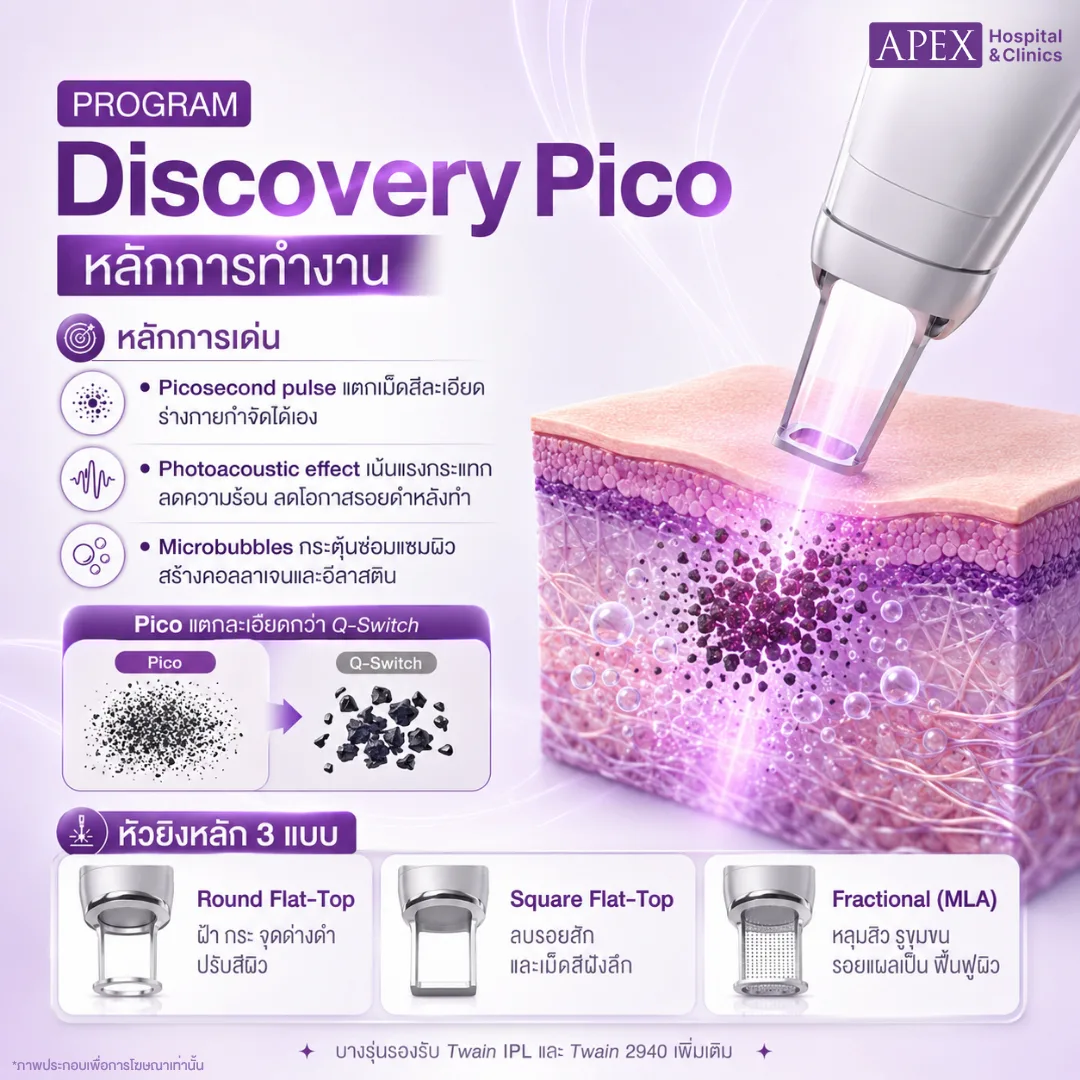 Discovery Pico คืออะไร