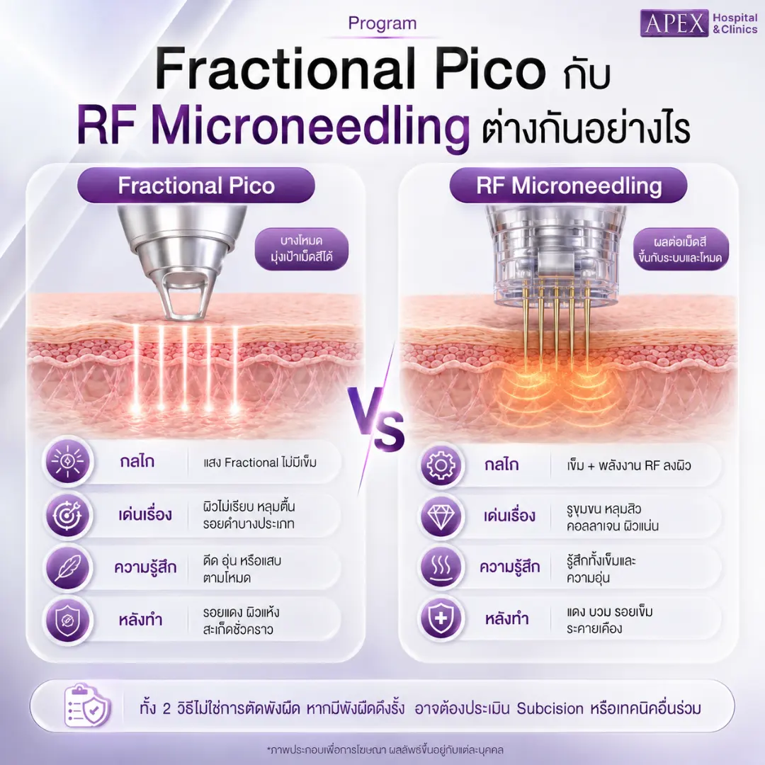 Fractional Pico กับ RF Microneedling ต่างกันอย่างไร