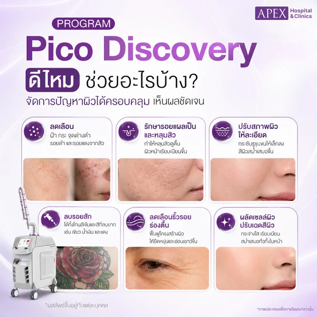 Pico Discovery ดีไหม ช่วยอะไรบ้าง