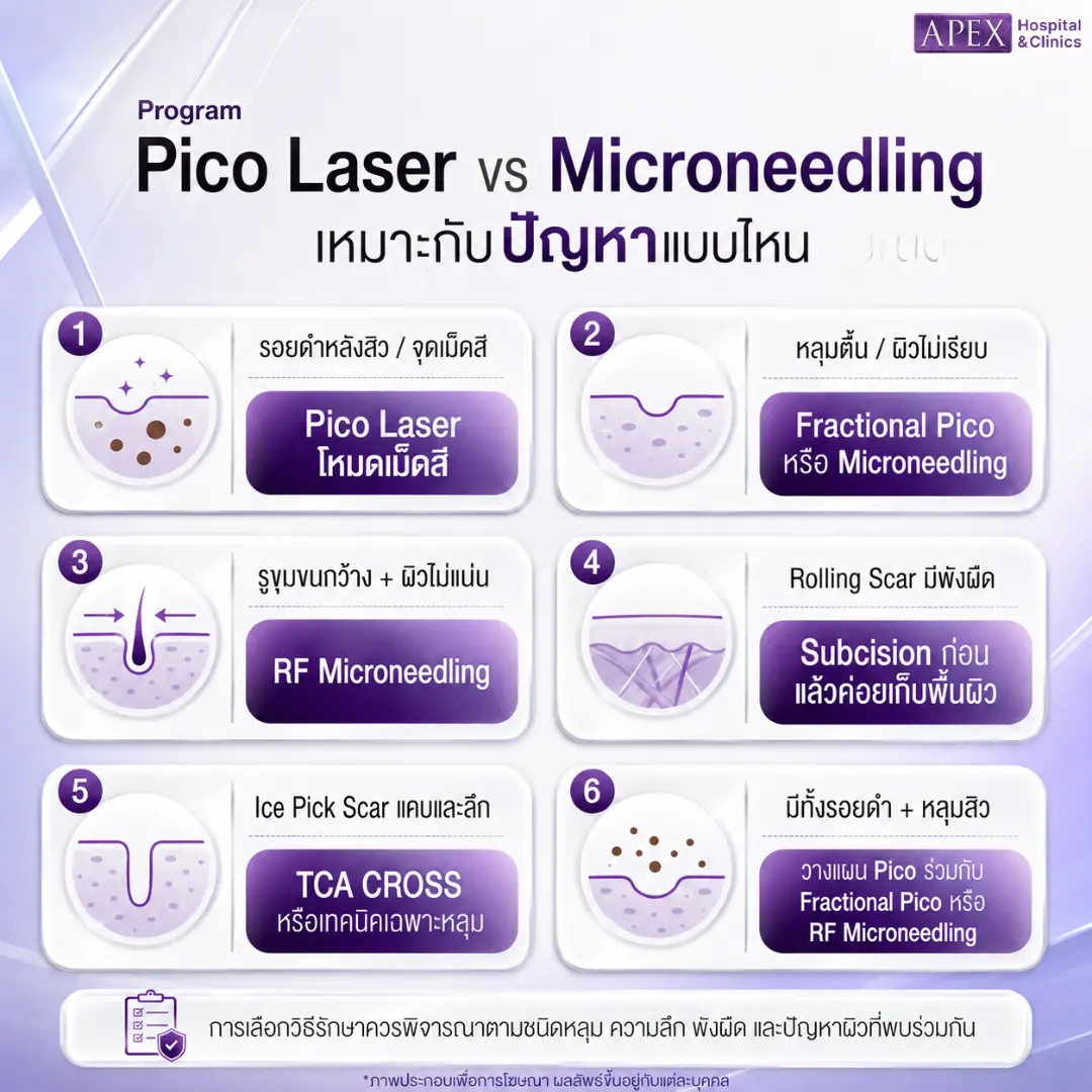 Pico Laser vs Microneedling เหมาะกับปัญหาแบบไหน